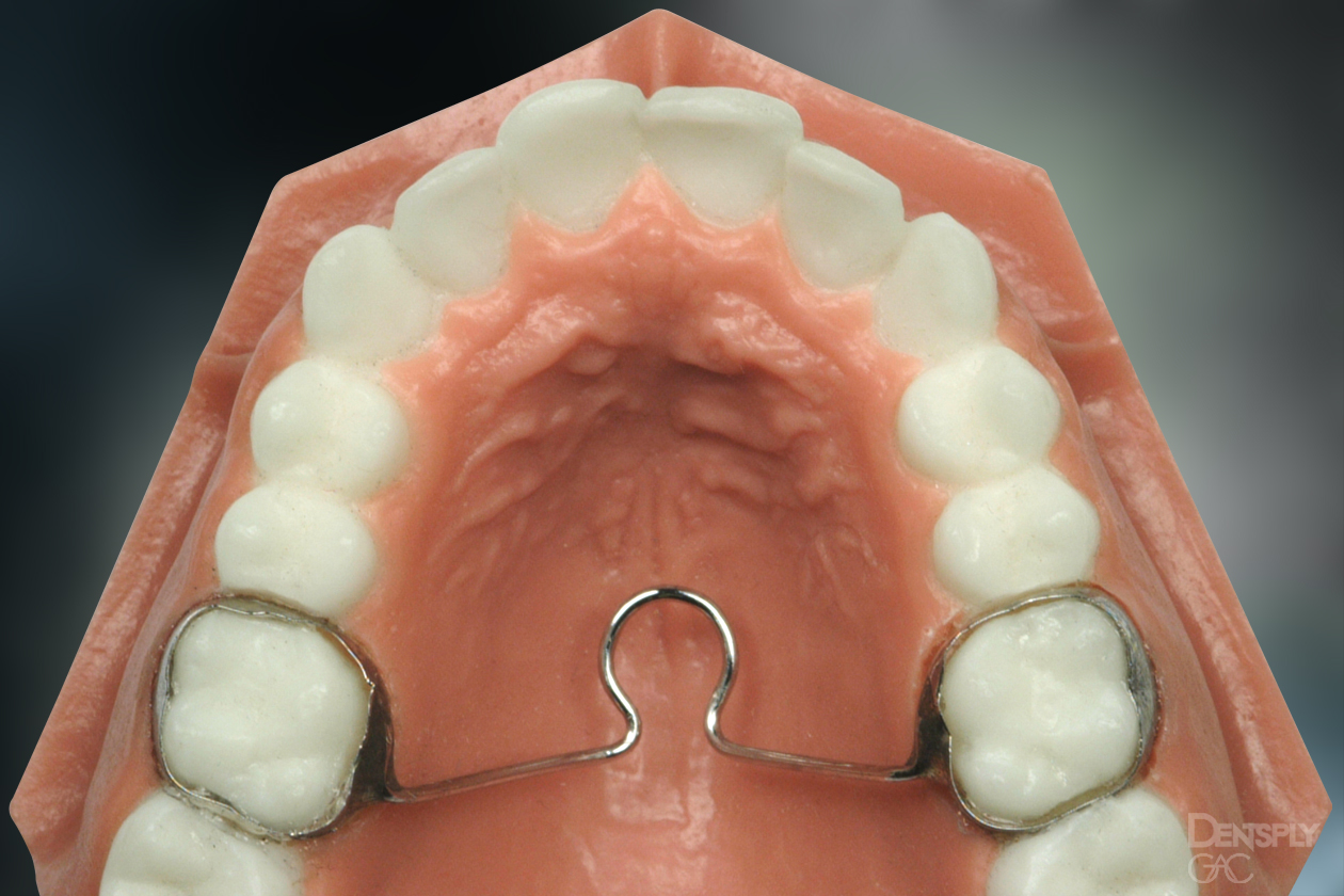 Demonstrates a TPA on a model of teeth.